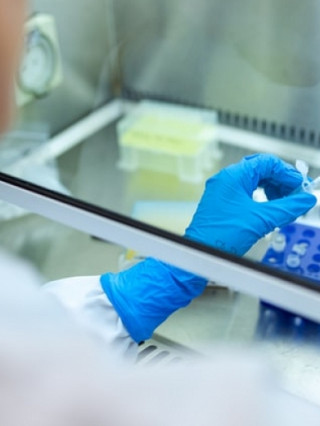 PCR тест за изследване на коронавирус (COVID-19) - УМБАЛ Пълмед