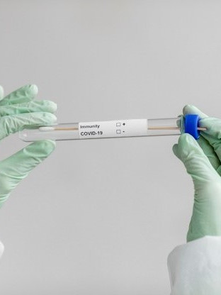 PCR тест и антигенен тест за коронавирус (COVID-19) - Клиника Малинов