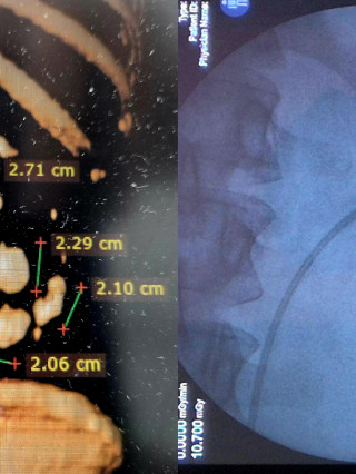 Д-р Петър Вътов