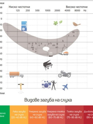 Аудиометрия - тест за изследване на слуха, МДЦ Орион