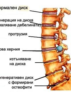 Безплатни профилактични прегледи при гръбначна болка - ДКЦ Пълмед